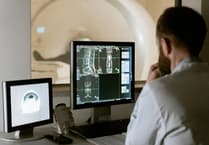 Wales lung cancer screening programme will save lives, say health experts