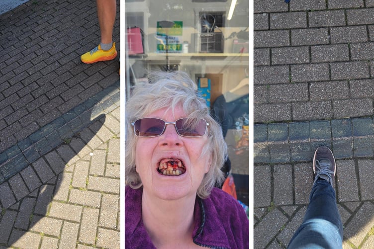 A Tenby woman suffered significant facial injuries after tripping and falling on the ‘unmarked’ kerb in Haverfordwest.